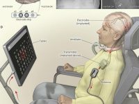脑机接口人体实验首度成功，它用50年把科幻电影变为现实
