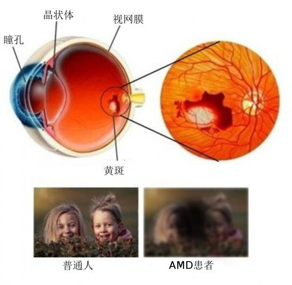CRISPR初显神威，基因手术让老鼠重现光明